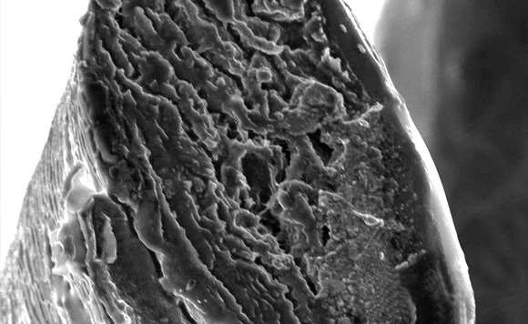 Mikroskopische Illustration eines Haarquerschnitts